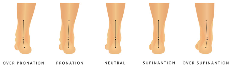 Fußstellungen von Überpronation bis Übersupination