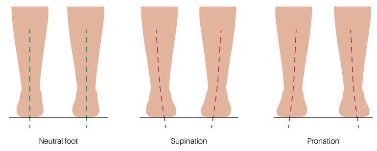 Normale Fußstellung, Supination und Pronation im Vergleich